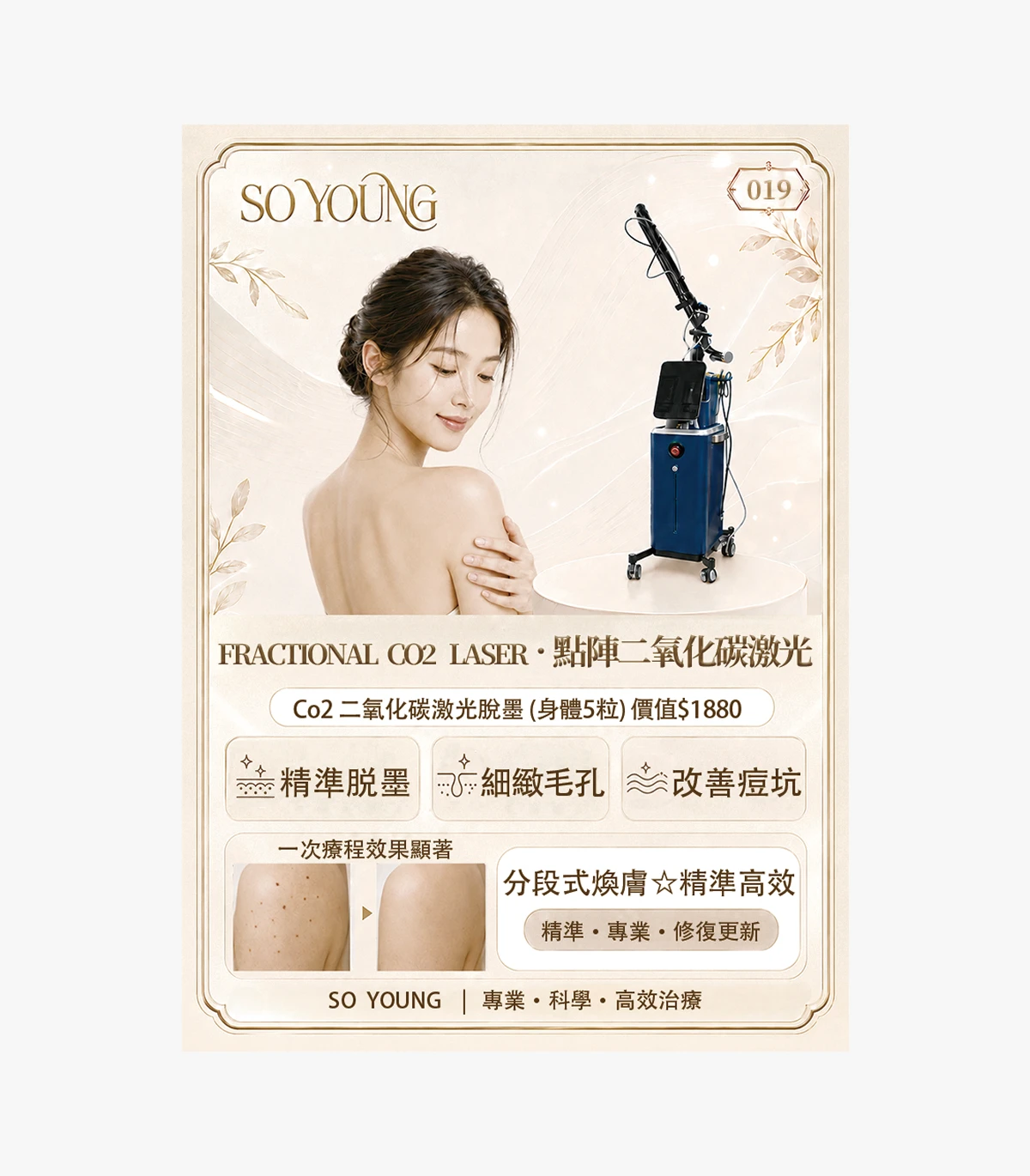 product-19 CO2 Laser Mole Removal (5 body moles) - Image 1
