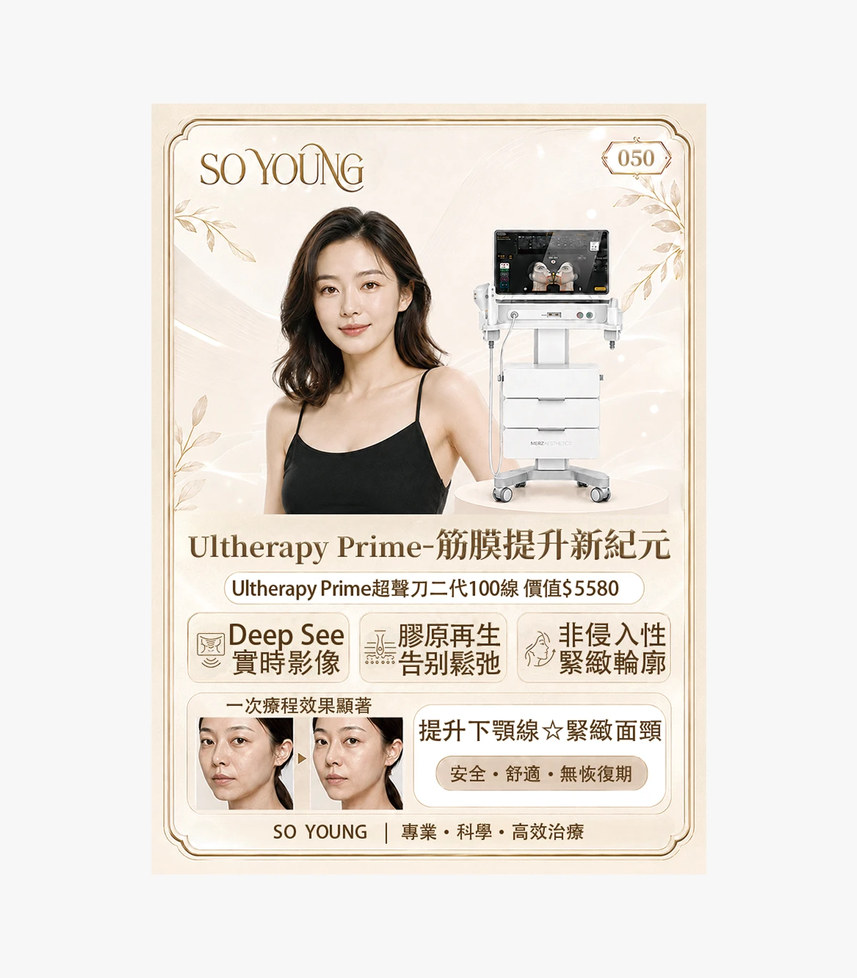 product-50 Ulthera Prime Second-Generation Ultrasound Lifting (100 lines) - Image 1