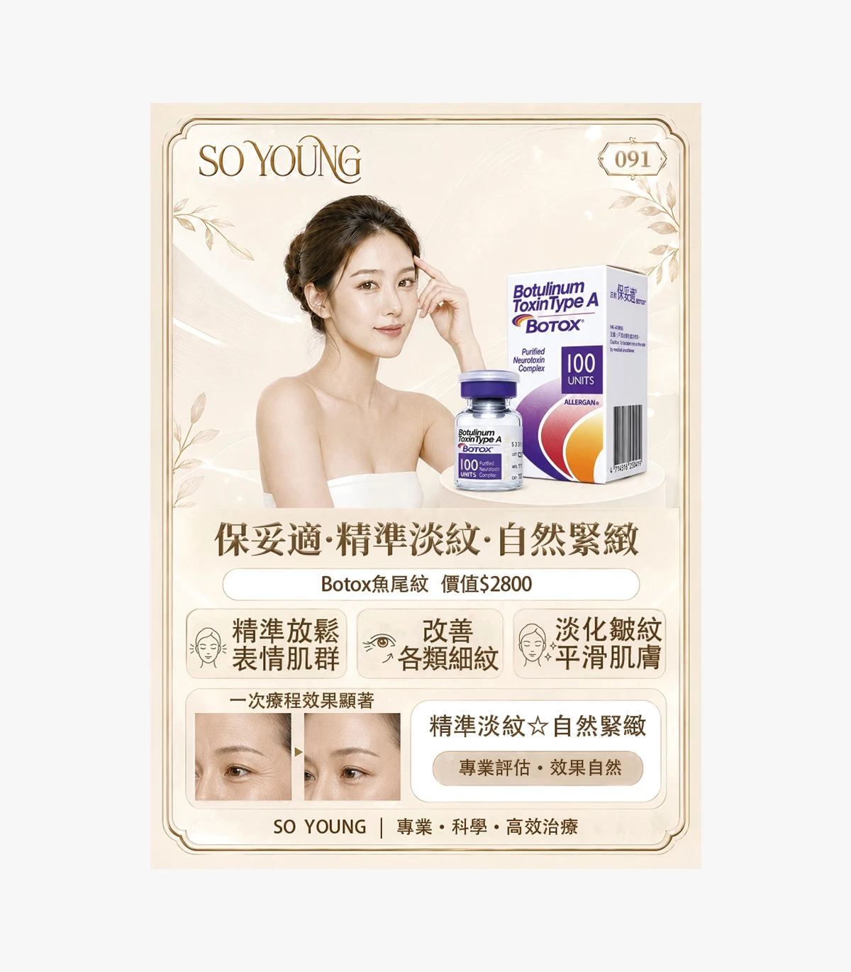 product-91 Botox Crow's Feet Treatment - Image 1